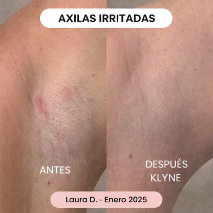 SilkDuo™ - Cuida zonas delicadas